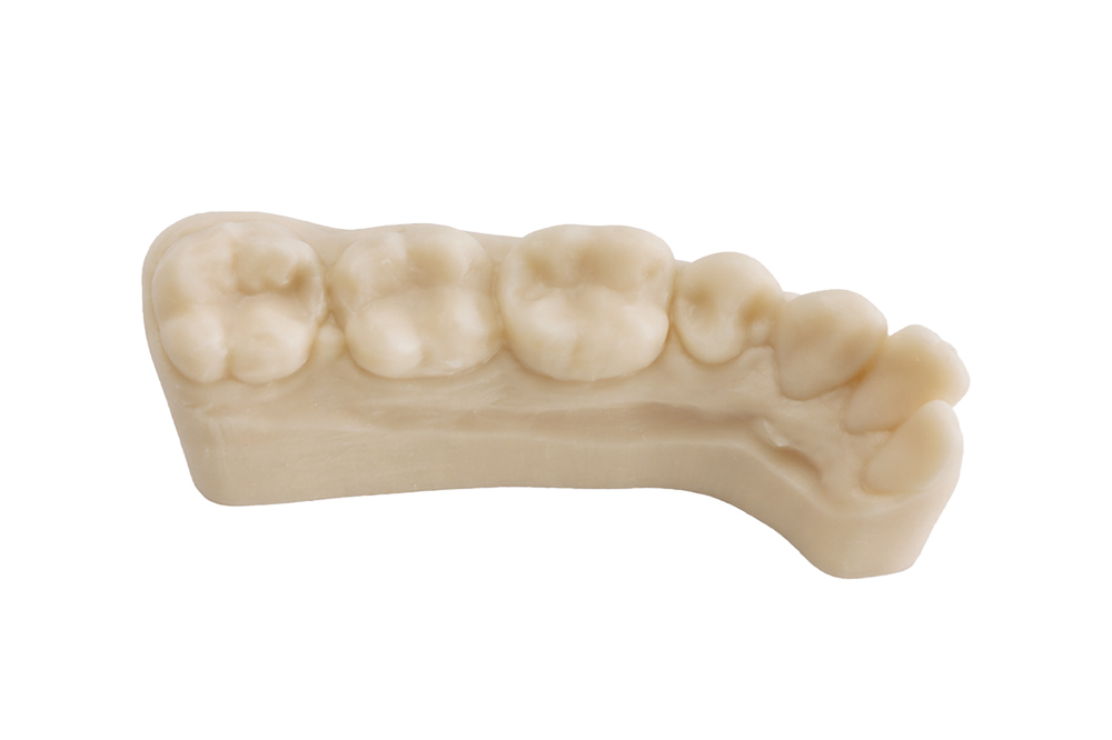 Argen Dental GmbH - Dienstleistungen - Drucken - Teilkiefer Argen Dental GmbH - Dienstleistungen - Drucken - Teilkiefer